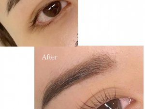 1 before after